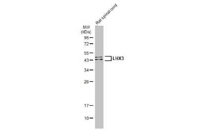 Western Blot: LHX3 Antibody [NBP3-13352]