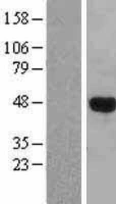 Western Blot: LHX3 Overexpression Lysate [NBL1-12515]