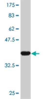 Western Blot: LHX5 Antibody (1D9) [H00064211-M01]