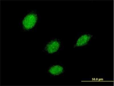 Immunocytochemistry/ Immunofluorescence: LHX5 Antibody (2A8) [H00064211-M04]