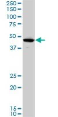 Western Blot: LHX5 Antibody (2B11) [H00064211-M05]