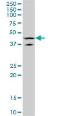Western Blot: LHX5 Antibody (2B11) [H00064211-M05]