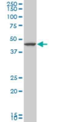 Western Blot: LHX5 Antibody (2B11) [H00064211-M05]