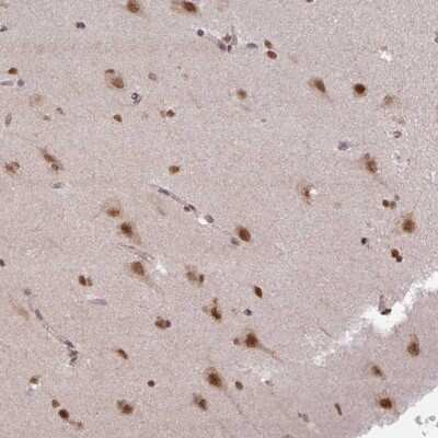 Immunohistochemistry: LHX5 Antibody [NBP2-49103]