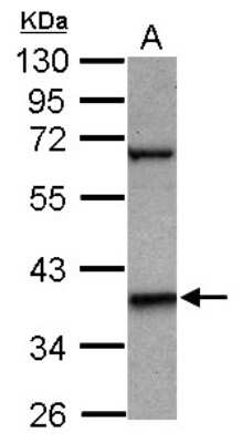 Western Blot: LHX5 Antibody [NBP2-15011]