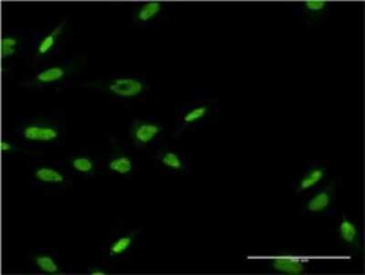 Immunocytochemistry/ Immunofluorescence: LHX6 Antibody (1B11) [H00026468-M02]