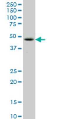 Western Blot: LHX6 Antibody (2A2) [H00026468-M06]