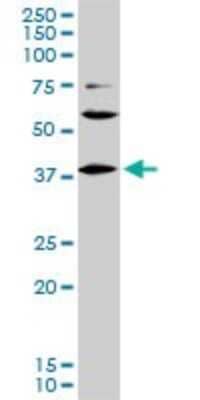 Western Blot: LHX6 Antibody (3D9) [H00026468-M01]