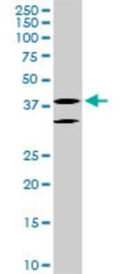 Western Blot: LHX6 Antibody (3E8) [H00026468-M05]