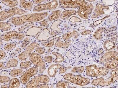 Immunohistochemistry-Paraffin: LHX6 Antibody [NBP2-97209]