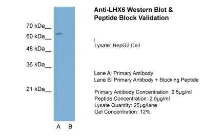 Western Blot: LHX6 Antibody [NB200-526]