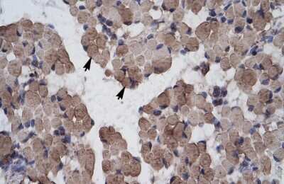 Immunohistochemistry: LHX9 Antibody [NBP2-87727]