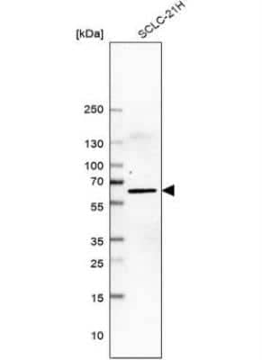 Western Blot: LHX9 Antibody [NBP1-86114]