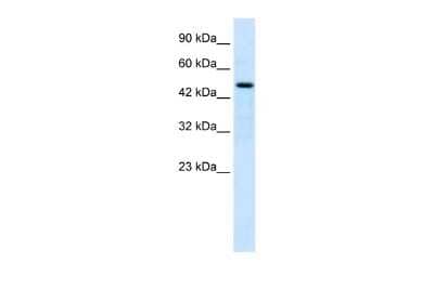 Western Blot: LHX9 Antibody [NBP2-87728]