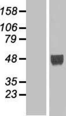 Western Blot: LHX9 Overexpression Lysate [NBP2-06676]