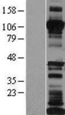 Western Blot: Cadherin-17 Overexpression Lysate [NBP2-10551]