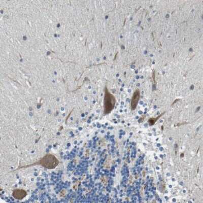 Immunohistochemistry-Paraffin: LIAS Antibody [NBP1-82845]