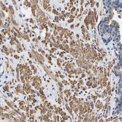 Immunohistochemistry-Paraffin: LIAS Antibody [NBP1-82845]