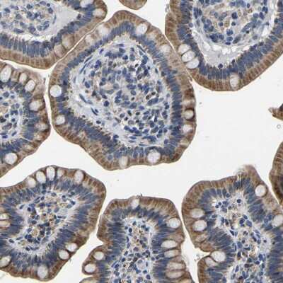 Immunohistochemistry-Paraffin: LIAS Antibody [NBP1-82845]