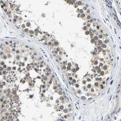 Immunohistochemistry-Paraffin: LIAS Antibody [NBP1-82845]