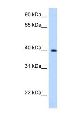 Western Blot: LIAS Antibody [NBP1-54320]