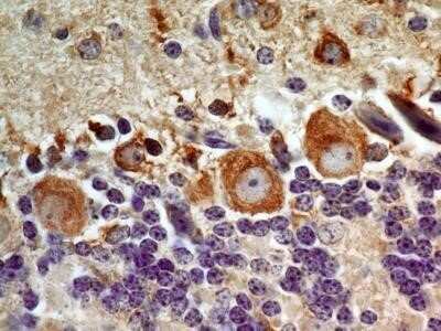 Immunocytochemistry: LIF Antibody (39N7D10) - Azide and BSA Free [NBP2-80834]