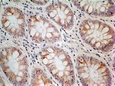 Immunohistochemistry: LIF Antibody (39N7D10) - Azide and BSA Free [NBP2-80834]