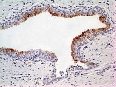 Immunohistochemistry: LIF Antibody (39N7D10) - Azide and BSA Free [NBP2-80834]