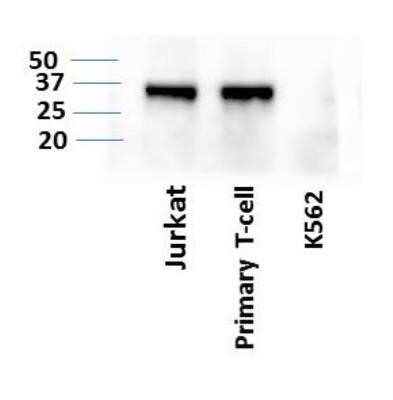 Western Blot: LIF Antibody (39N7D10)Azide and BSA Free [NBP2-80834]