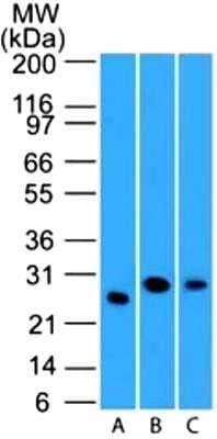 Western Blot: LIF Antibody (39N7D10)BSA Free [NBP2-27406]