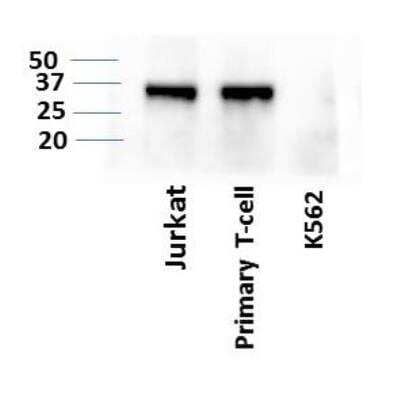 Western Blot: LIF Antibody (39N7D10)BSA Free [NBP2-27406]