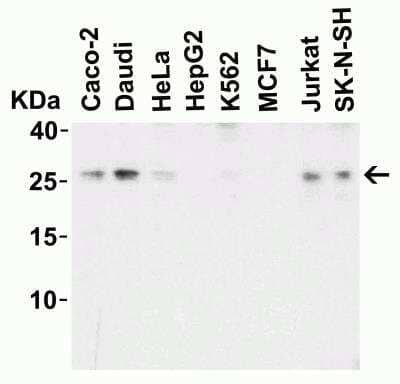 Western Blot: LIF AntibodyBSA Free [NBP1-76554]
