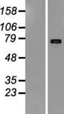 Western Blot: LIFR alpha Overexpression Lysate [NBP2-08126]