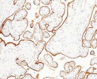 Immunohistochemistry-Paraffin: LIFR alpha Antibody (1) [NBP2-89586]