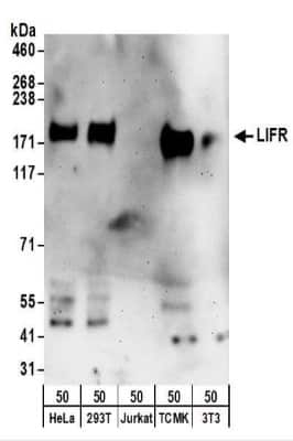 Western Blot: LIFR alpha Antibody [NBP2-32070]