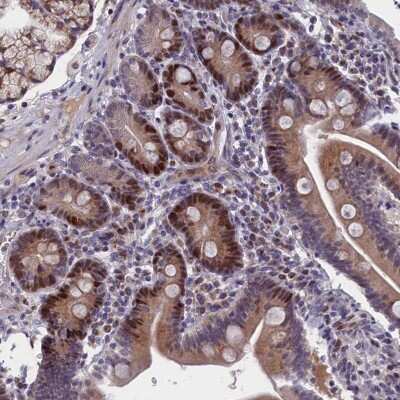 Immunohistochemistry: DNA Ligase I Antibody [NBP2-32603]