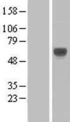 Western Blot: ILT6/CD85e/LILRA3 Overexpression Lysate [NBL1-12525]