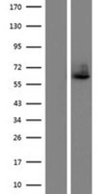 Western Blot: ILT7/CD85g/LILRA4 Overexpression Lysate [NBP2-07461]