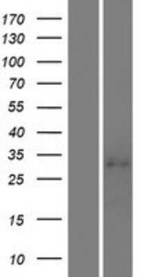 Western Blot: ILT11/LILRA5 Overexpression Lysate [NBP2-06535]