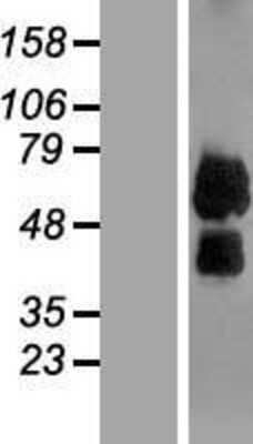 Western Blot: ILT3/CD85k/LILRB4 Overexpression Lysate [NBP2-07571]