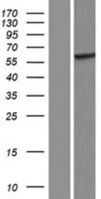 Western Blot: LIR-8/CD85c/LILRB5 Overexpression Lysate [NBP2-08419]