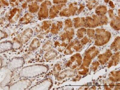 Immunohistochemistry-Paraffin: LIM Kinase 1 Antibody (1A8) [H00003984-M01]