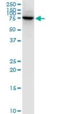 Western Blot: LIM Kinase 1 Antibody (1A8) [H00003984-M01]