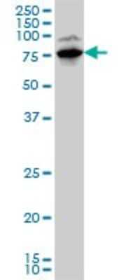 Western Blot: LIM Kinase 1 Antibody (1A8) [H00003984-M01]