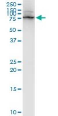 Western Blot: LIM Kinase 1 Antibody (1A8) [H00003984-M01]
