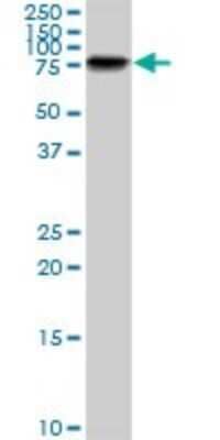 Western Blot: LIM Kinase 1 Antibody (1A8) [H00003984-M01]