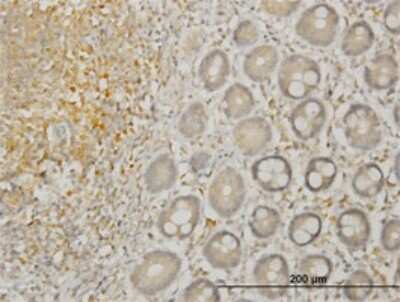 Immunohistochemistry-Paraffin: LIM Kinase 1 Antibody (1B2) [H00003984-M02]
