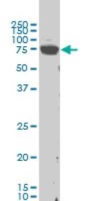 Western Blot: LIM Kinase 1 Antibody (1B2) [H00003984-M02]