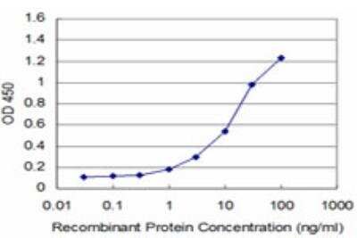 ELISA: LIM Kinase 1 Antibody (2E9) [H00003984-M05]