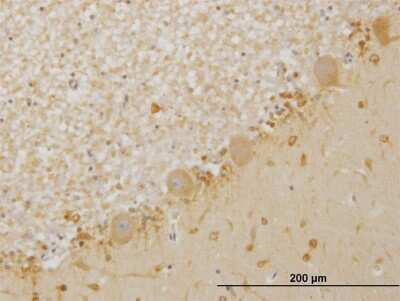 Immunohistochemistry-Paraffin: LIM Kinase 1 Antibody (2E9) [H00003984-M05]